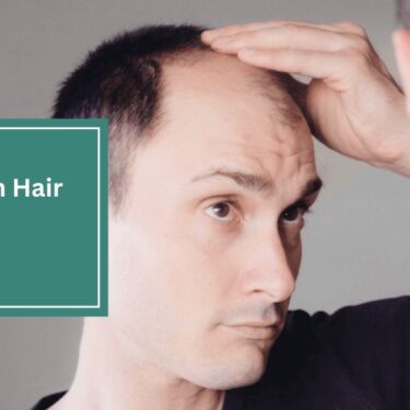 Marek Health Hair Loss