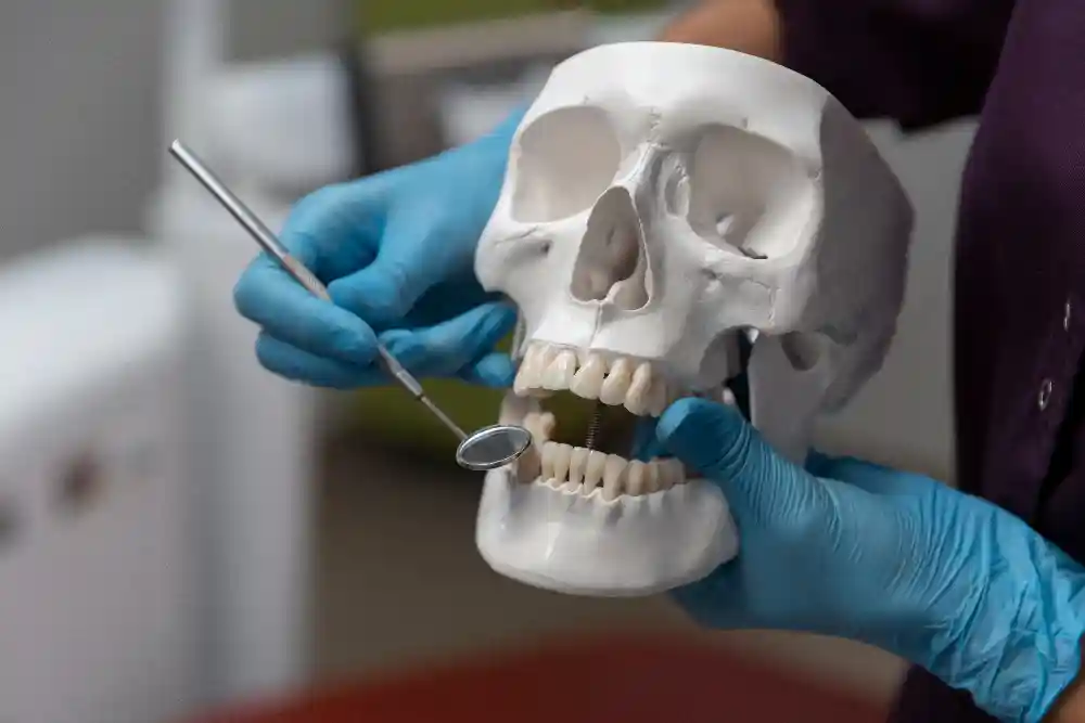 FAQs About Dental Implants