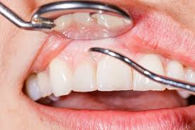 How Family Dentistry Protects Your Family’s Oral Health