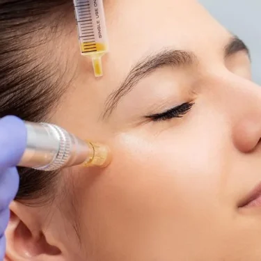 How Long Does Botox Last?