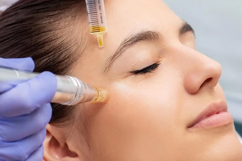How Long Does Botox Last?
