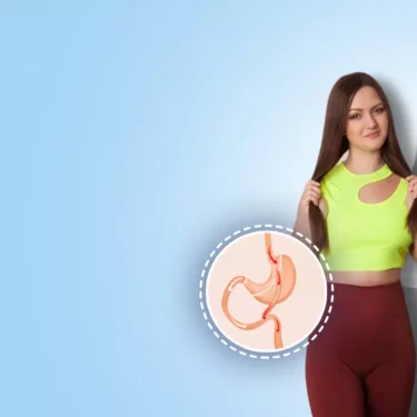The Impact of Tummy Tuck on Self-Esteem and Lifestyle