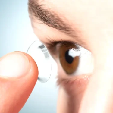 What Is Keratoconus and How Is It Treated?