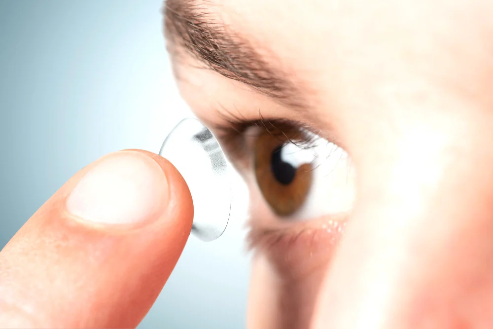 What Is Keratoconus and How Is It Treated?