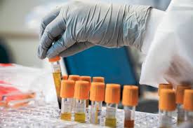 What You Need to Know About STIs