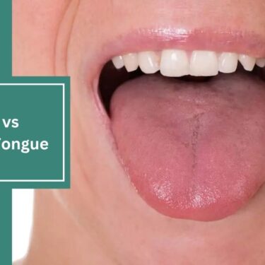 Healthy vs Unhealthy Tongue