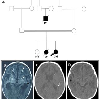 The Role of Neurologists in Diagnosing Neurological Disorders