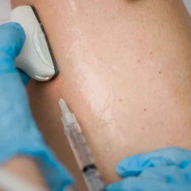 Understanding What to Expect During Your First Visit to a Vein Clinic