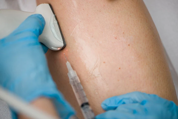 Understanding What to Expect During Your First Visit to a Vein Clinic