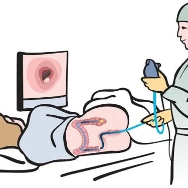 What To Expect During Your Colonoscopy Procedure