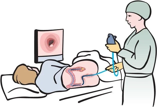 What To Expect During Your Colonoscopy Procedure